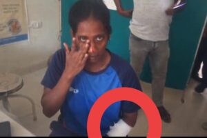 ক্রিকেট মাঠে রক্তাক্ত মহিলা ক্রিকেটার